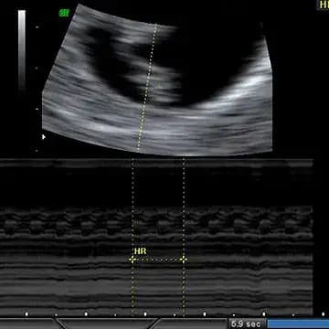 Week 6 ultrasound image